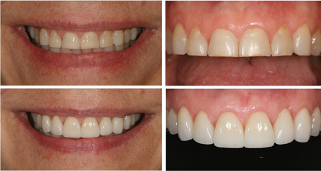 Cosmetic And Restorative Solutions