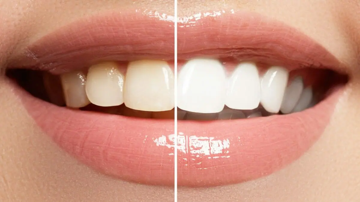 Cosmetic Dentistry