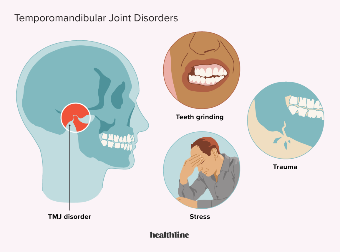 How Stress Affects Your Teeth