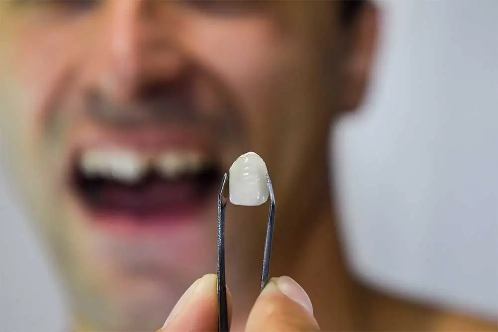 Previous Dental Work That Has Failed