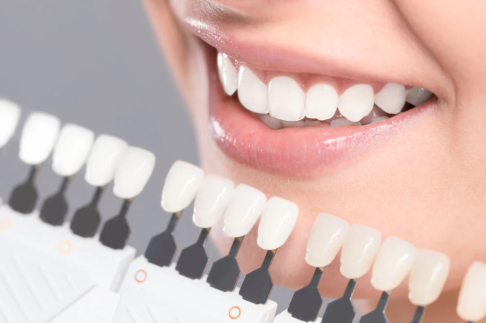 Teeth Whitening and the Rise of Dopamine Dressing