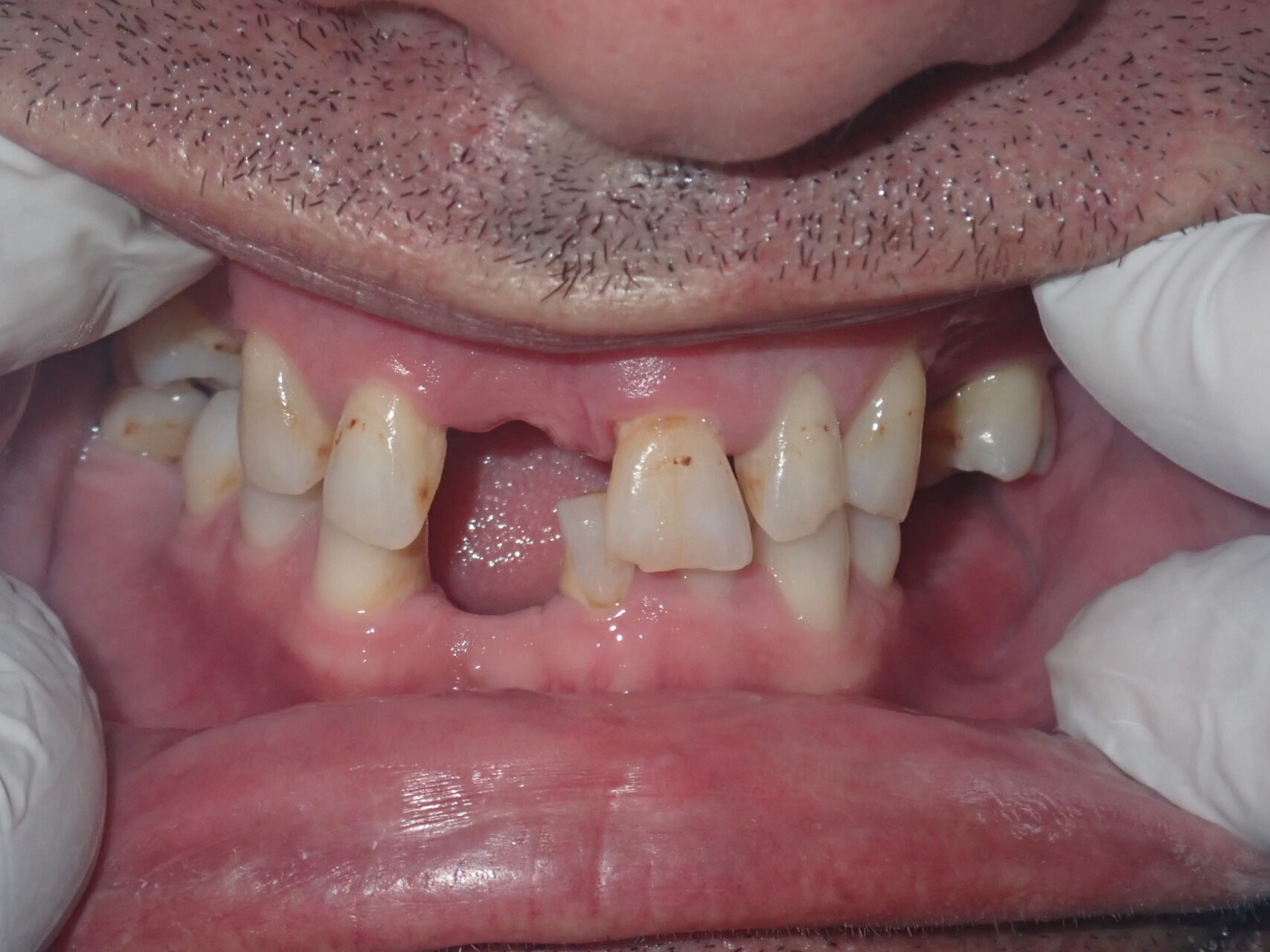 Case3-Before