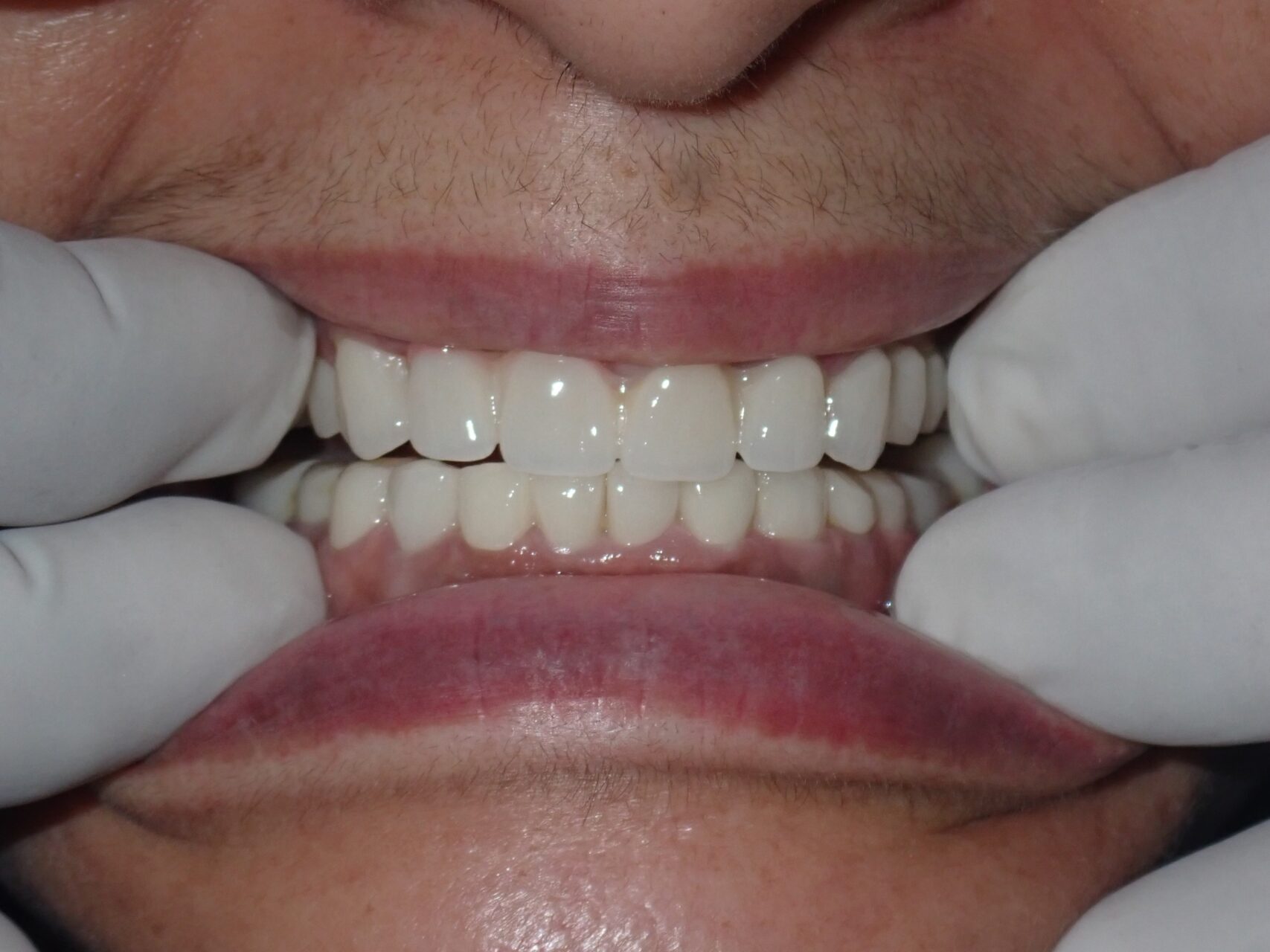 Case_3-After