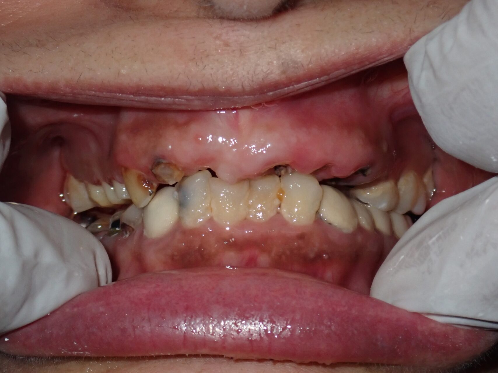 Case3-Before