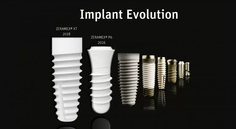 Technological Advancements In Dental Implants