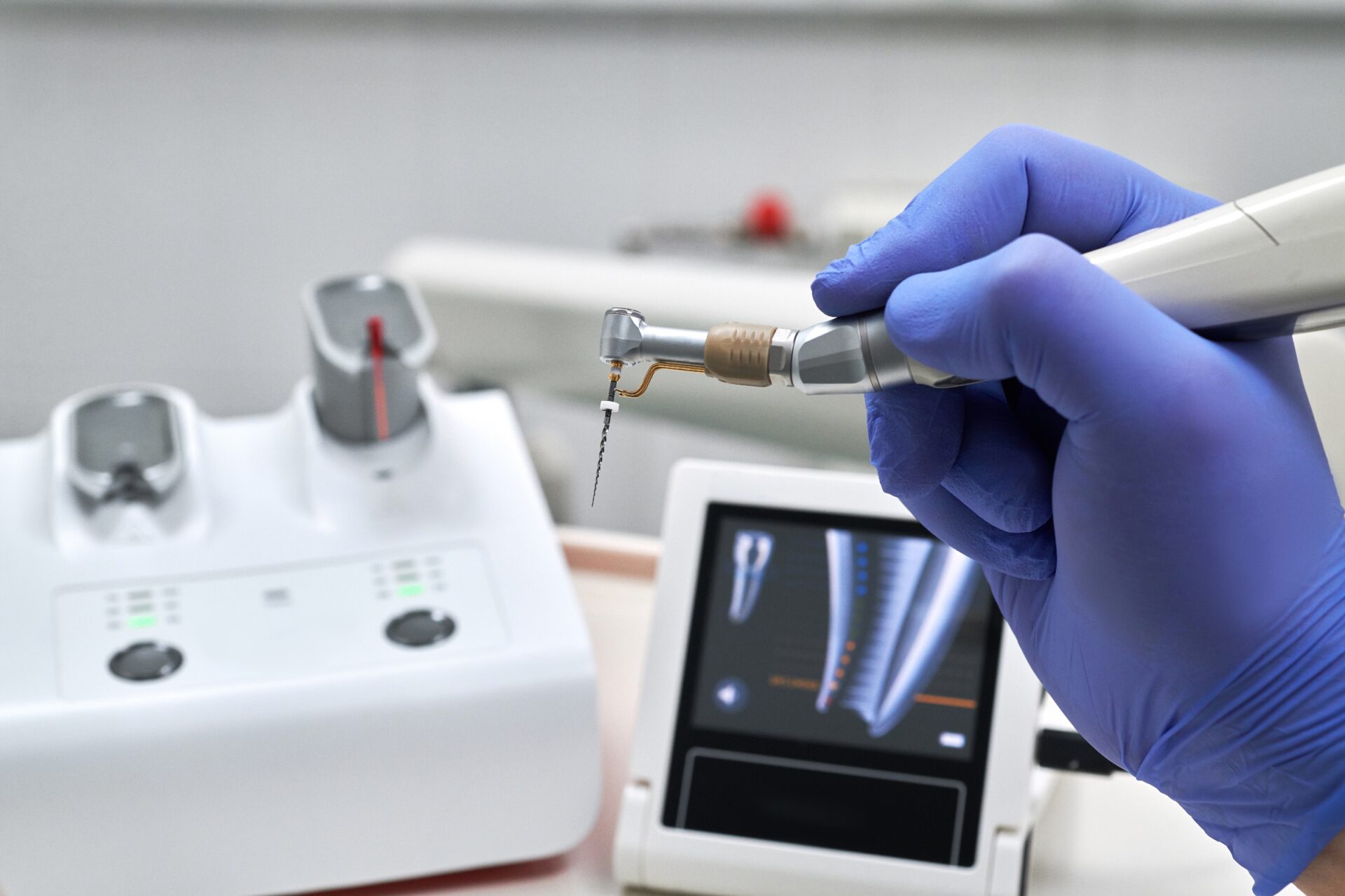 Technology Behind Same Day Root Canal