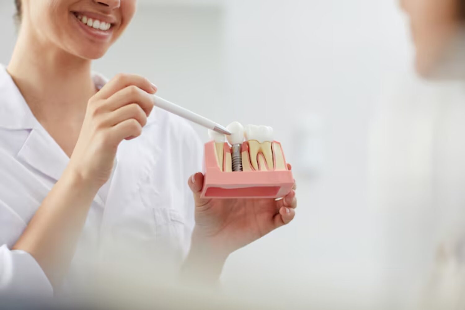 The Future Of Dental Implant